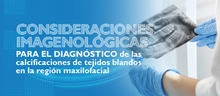 Consideraciones imagenológicas para el diagnóstico de las calcificaciones de tejidos blandos en la región maxilofacial